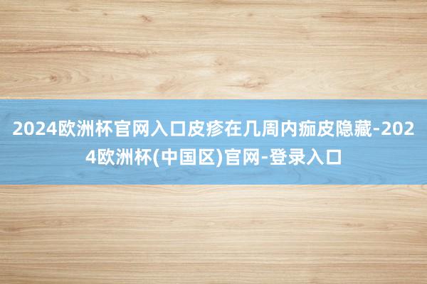 2024欧洲杯官网入口皮疹在几周内痂皮隐藏-2024欧洲杯(中国区)官网-登录入口